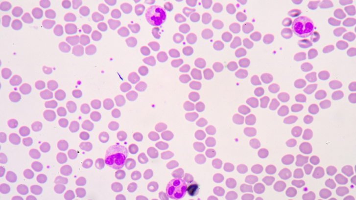 Bloedstollend hemofilie